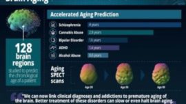 Cosas que envejecen prematuramente tu cerebro